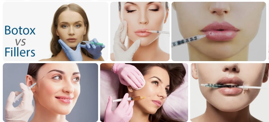 Botox And Fillers: What’s The Difference?